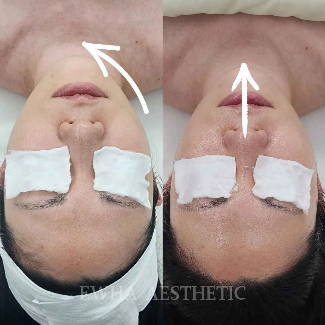 상)천안시 쌍용동 이화에스테틱 천안점